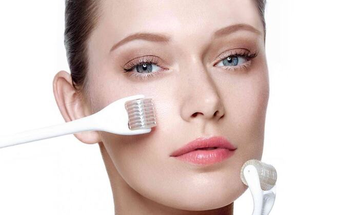 microneedling-hudalex-1024x602-1(1)